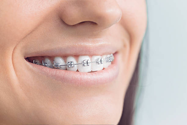 Best Wisdom Tooth Removal  in Plainville, KS